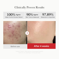 MEDICUBE Red Succinic Acid Panthenol Pads