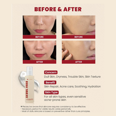 K-Secret Seoul 1988 Essence Snail Mucin 97% + Rice 100ml