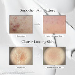 Reedle Shot 300 50Ml