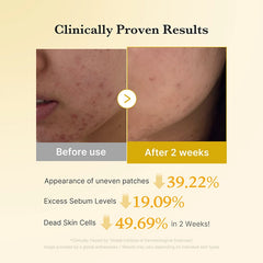 medicube - Kojic Acid Turmeric Pad 70 Pads