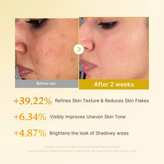 Medicube Kojic Acid Turmeric Toner 250ml ميديكيو تونر الكوجيك أسيد والكركم 250 مل