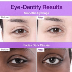 Numbuzin No.9 NAD Under Eye Patches